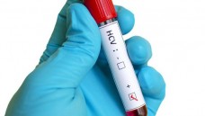 Rote-Hand-Brief: Bei chronischen Trägern des Hepatitis-B-Virus sei  es unter der Behandlung mit BCR-ABL-Tyrosinkinase-Inhibitoren zu HBV-Reaktivierungen gekommen. (Foto: jarun011 / Fotolia)
