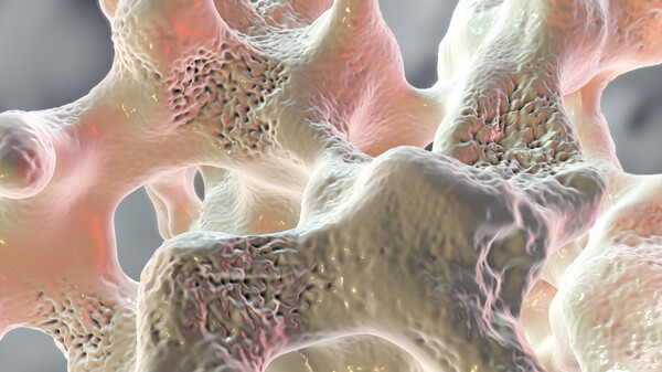 Neuer Osteoporose-Antikörper – jetzt doch!