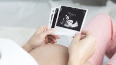 Durch die Antibabypille erhöht sich die Wahrscheinlichkeit für schwere Geburtsfehler nicht (Quelle: mmphoto/Fotolia)