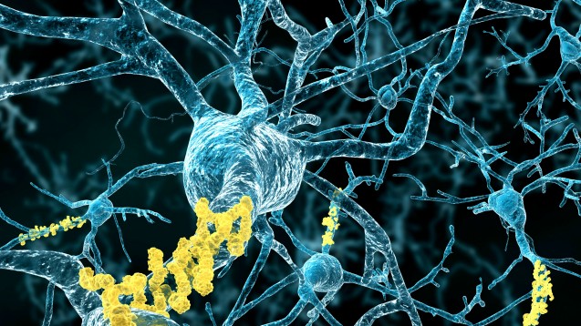 Geschädigtes Gehirn: Pathologische Prozesse in der Petrischale blockiert, (Foto: Juan Gärtner / Fotolia)