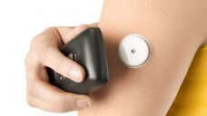 Intermittierend gescanntes Glucose-Monitoring: Blutzuckermessen ohne Blut. ( r / Foto: Abbott)