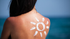 Langsam an die Sonne gewöhnen und Sonnenschutzpräparate mit hohem UV-A-Schutz, ohne Emulgatoren verwenden – so kann man einer Mallorca-Akne vorbeugen. (Foto: Cara-Foto / stock.adobe.com)