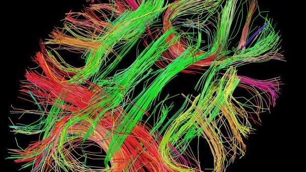 Funktionale Fingerabdrücke im Gehirn - wie ein Fingerabdruck (Screenshot: humanconnectomeproject)