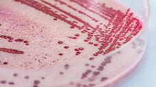 Die Antibiotikaforschung läuft nach Ansicht der WHO bedrohlich langsam. Hoffnung machen vor allem Wirkstoffe, die sich noch in frühen Entwicklungsstufen befinden. (r / Foto: Photographee.eu / stock.adobe.com)