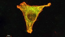 Thalidomid inaktiviert  in einer Tumorzelle einen bestimmten Proteinkomplex (gelb). Dieser Mechanismus ruft auch Fehlbildungen bei Ungeborenen hervor. In der Apotheke gibt es die Substanz nur auf  T-Rezept. (Foto: Bassermann/MRI)