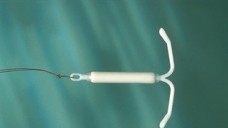 Bei der Anwendung eines Intrauterinpessars können Uterusperforationen auftreten. (Foto: Jenapharm)
