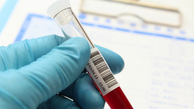 Welche Beweiskraft haben Blutproben, die von Krebspatienten des Bottroper Zyto-Apothekers genommen wurden? (Foto: cassis / stock.adobe.com)