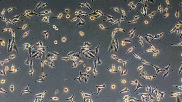 Sie vermehren sich immer weiter: Gefärbte Zellen aus der Zelllinie von Henrietta Lacks. (Foto: Loren Rodgers / Fotolia)