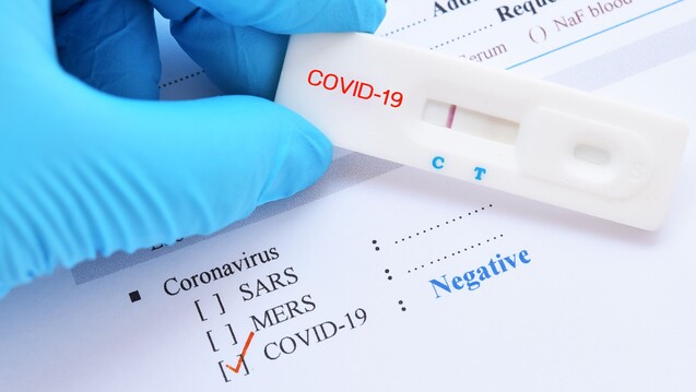 Antigen-Schnelltests auf SARS-CoV-2 könnten helfen, akute COVID-19-Erkrankungen effizienter nachzuweisen. (Foto:&nbsp;jarun011 / stock.adobecom)