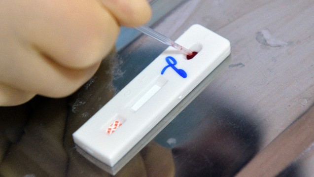 Auch älteren Menschen sollten verstärkt HIV-Tests angeboten werden, fordern Experten. (Foto:dpa)