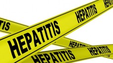 An Hepatitisinfektionen sterben mehr Menschen als an HIV/Aids. (Bild: waldemarus/Fotolia)