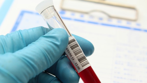 Könnten Blutproben den Zyto-Apotheker überführen? 