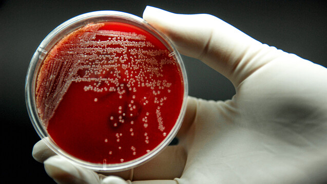 Einer aktuellen Umfrage zufolge wissen die Fachkräfte im Gesundheitswesen zu wenig über Antibiotika-Resistenzen. (Foto: imago images / Xinhua)