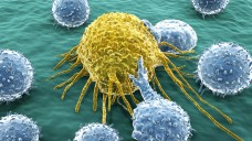 Eine Reihe von Krebsarten wird immer besser behandelbar. (Bild: Juan Gärtner/Fotolia.com)