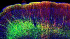 Mit bildgebenden Verfahren konnten Forscher die Aktivität der Nervenbahnen in Mäusegehirnen genau verfolgen. (Foto: Universitätsklinikum Heidelberg)