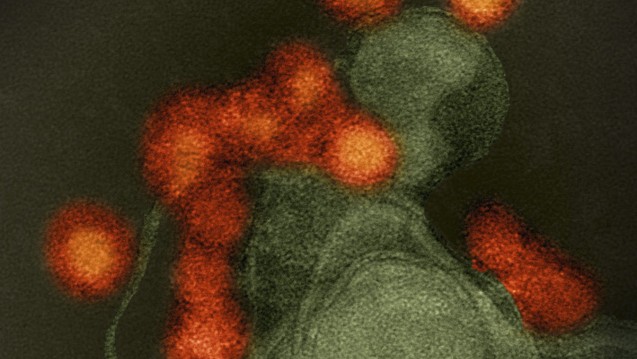 Stamm, rot eingefärbt: Das Zika-Virus (Ektronenmikroskopische Aufnahme: National Institute of Allergy and Infectious Diseases (NIAID))