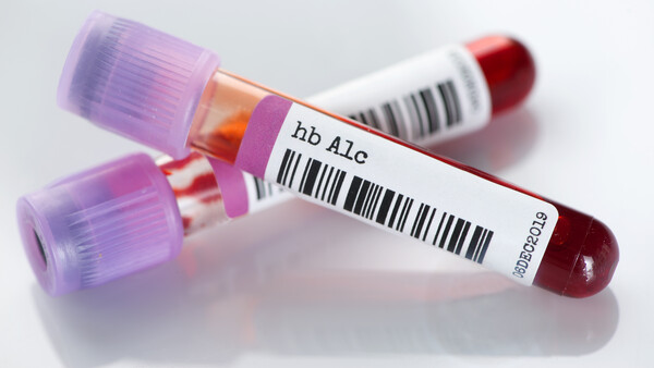 PPI verringern Blutzucker-Werte