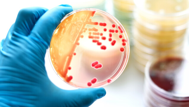 Antibiotika-Resistenzen sind einer neuen Studie zufolge zwar ein europaweites Problem, Präventions- und Kontrollstrategien müssten aber auf jedes Land einzeln zugeschnitten werden. (m / Foto: jarun011 / stock.adobe.com)