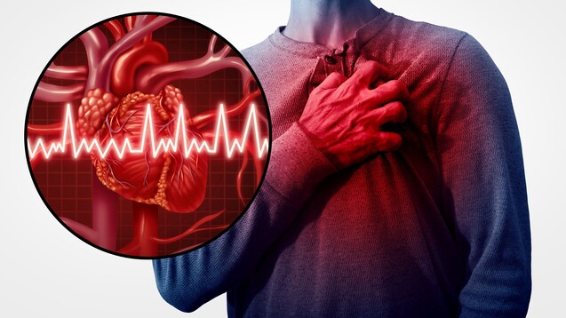Patienten mit Gicht sollten bei kardiovaskulären Risikofaktoren wie Herzinfarkt oder Schlaganfall nicht mit Febuxostat behandelt werden. Der Grund: Febuxostat erhöht bei diesen Patienten die Sterblichkeit. ( r /Foto: freshidea / stock.adobe.com)