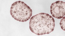 Es gibt noch immer Menschen, die an der Existenz des Masernvirus zweifeln. (Foto: Hans R. Gelderblom, Freya Kaulbars. Kolorierung: Andrea Schnartendorff/RKI)