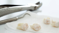 Die FDA warnt vor schweren Zahnproblemen bei sublingualer Buprenorphintherapie, wie bei Schmerzen oder zur Substitution. Was können Buprenorphinpatienten tun, um das Risiko für Zahnprobleme zu verringern? (Foto:&nbsp;sebra / AdobeStock)