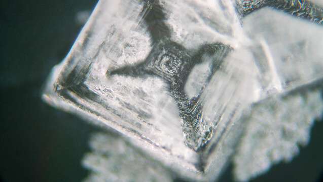 Uratkristalle sind unter dem Mikroskop schön anzusehen, können aber sehr schmerzhaft sein, wenn sie in der Synovialflüssigkeit ausfallen und einen verheerenden inflammatorischen Teufelskreis verursachen. (Foto: luchschenF / stock.adobe.com)