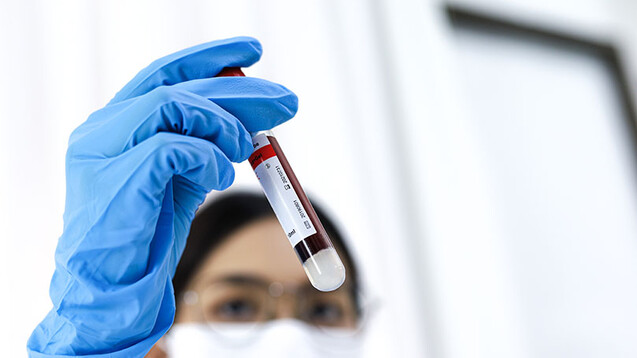 Neuere T-Zell-Tests lassen sich direkt mit Blutproben ohne besondere Aufbereitung durchführen.&nbsp;(s / Foto: Charlie's / AdobeStock)