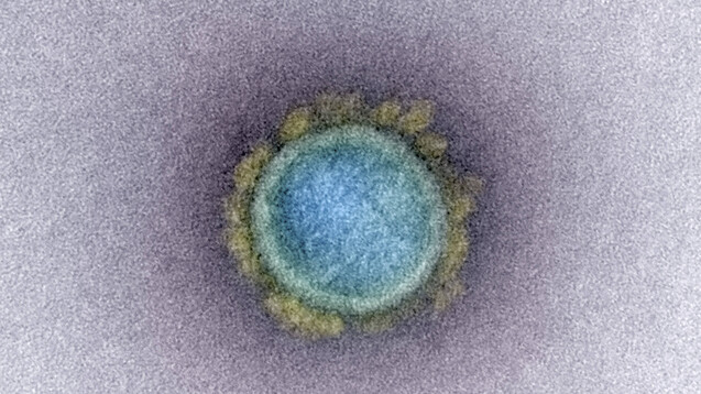 SARS-Viren und auch das neue SARS-CoV-2 nutzen das transmembranäre Enzym ACE2 (Angiotensin Converting Enzyme 2) als Rezeptor, um in ihre Wirtszellen zu gelangen. Doch begünstigen ACE-Hemmer deswegen schwere Verläufe? Eine diesbezügliche Hypothese ist bislang nicht bestätigt. (c / Foto: imago images / ZUMA Wire)