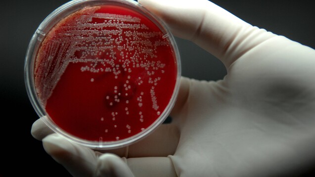 Die WHO warnt davor, dass es aufgrund von Antibiotikaresistenzen dazu kommen könnte, dass 100 Jahre Forschung an Antibiotika zunichte gemacht werden könnte. (Foto: imago images / Xinhua)