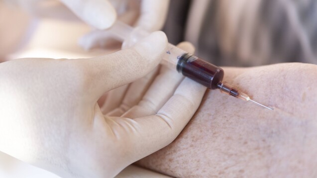Das OVG NRW hat entschieden: Die Bezirksregierung Münster hat Heilpraktikern zu Recht untersagt, ihren Patienten Blut zur Herstellung von Eigenblutprodukten zu entnehmen. (Foto: IMAGO / Westend61)