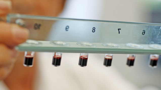 Wie ist das Risiko-Nutzen-Verhältnis von Xarelto? Eine Bayer-Wissenschaftlerin analysiert Blutproben. (Foto: picture alliance / dpa) 