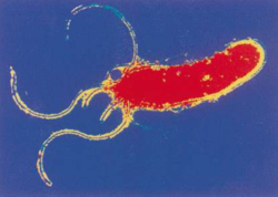 D272011_pri_helicobacter.jpg